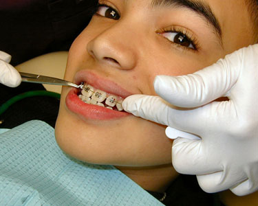 Kids Tampa: Orthodontists - Fun 4 Tampa Kids